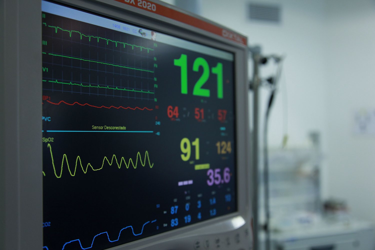 A real bedside monitor showing heart tracings and vital numbers